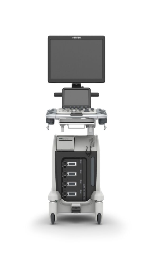 【画像】超音波装置：ARIETTA 65LE LV