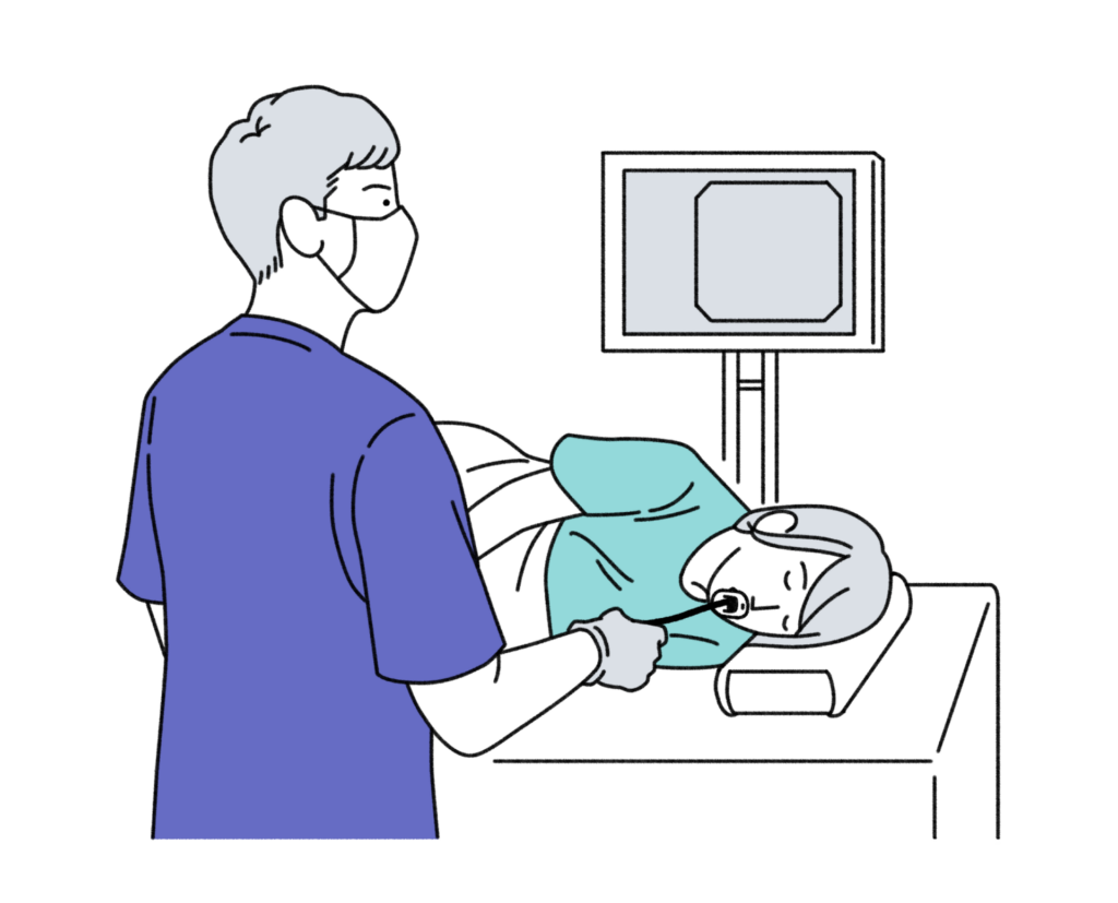 【イラスト】内視鏡検査