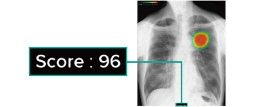 【画像】スコア表示機能01